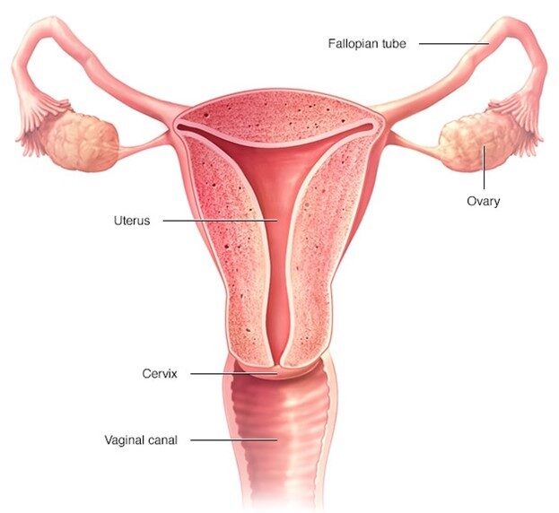 Ovarian Cyst